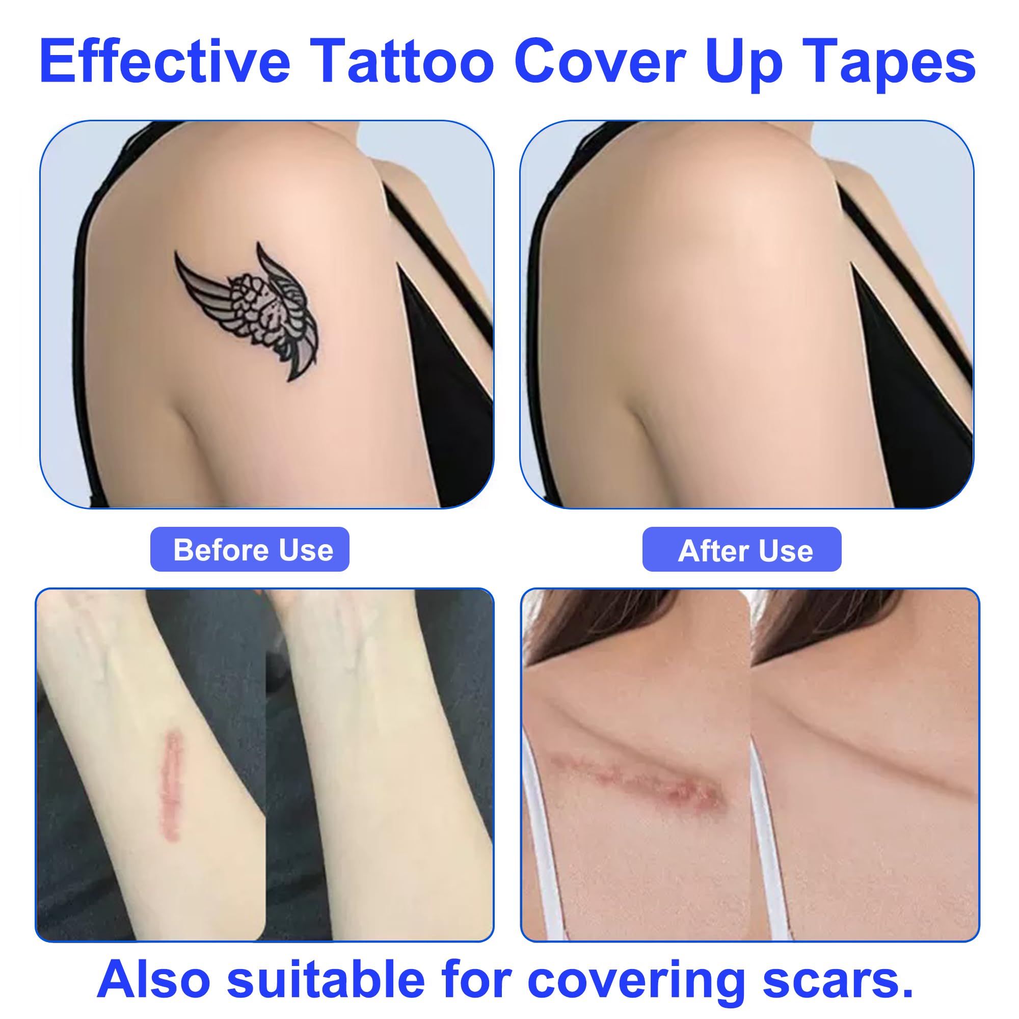 Anvosy tattoo cover up patch on-skin application enables quick concealment of tattoos.