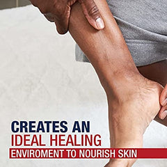 Cracked feet use case with Aquaphor application