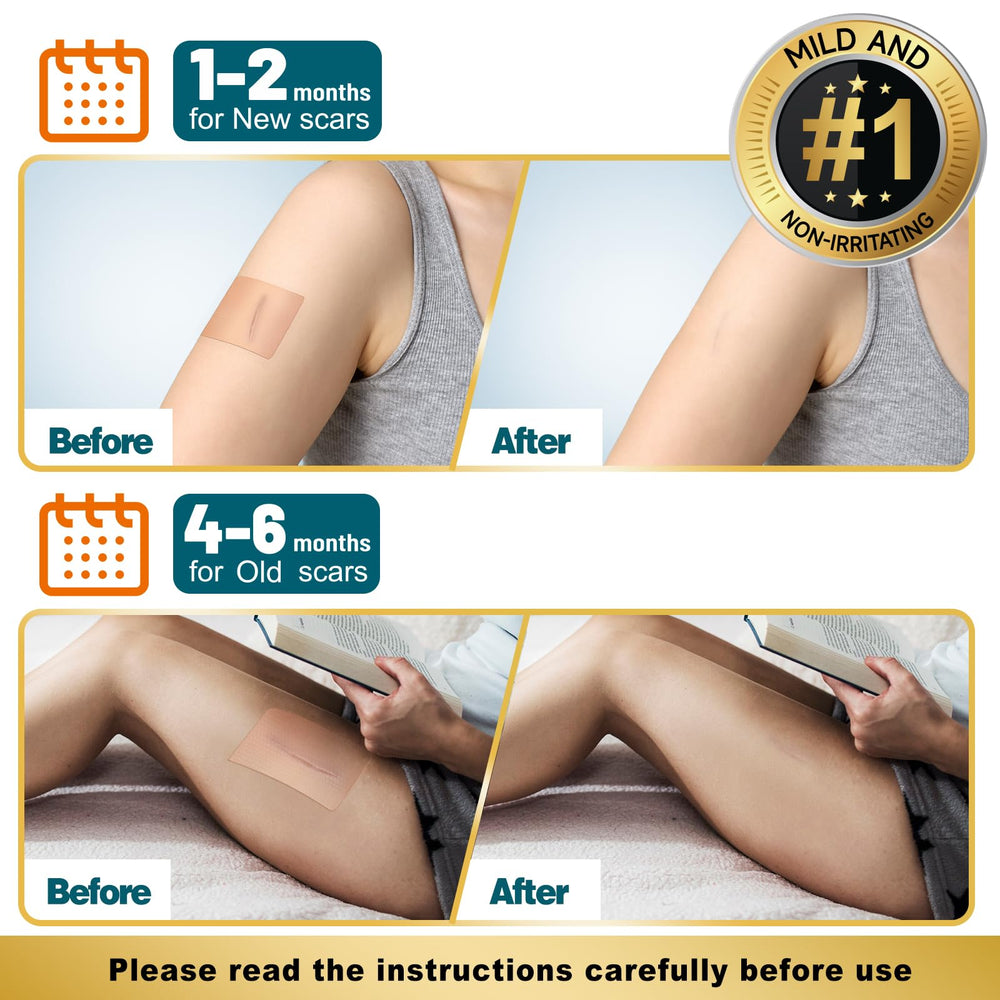 Arme scar sheets with extended 24-hour adhesion for continuous wear.