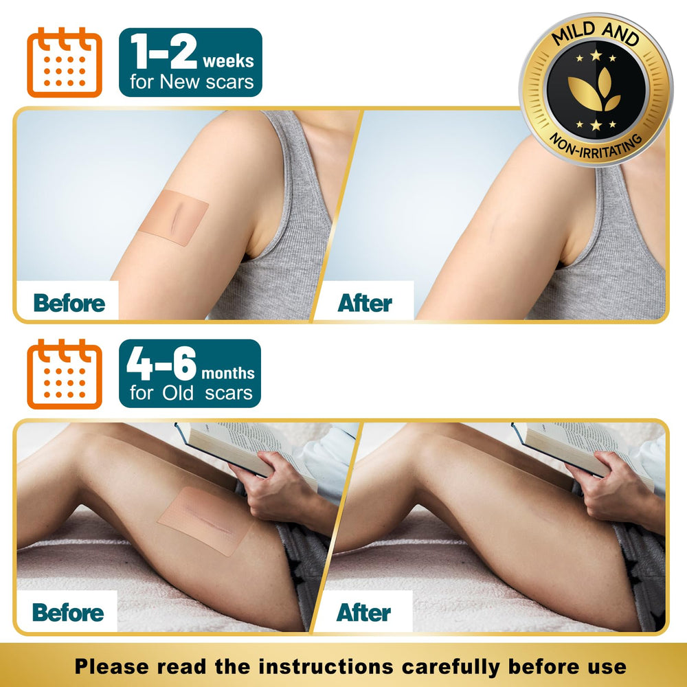 Arme scar tape packaging box for easy storage and purchase