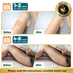 Arme scar tape packaging box for easy storage and purchase