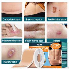 Arme packaging shows two rolls ready to support long-term scar care.