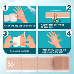 Arme scar tape's soft breathable material supports wear without irritation.