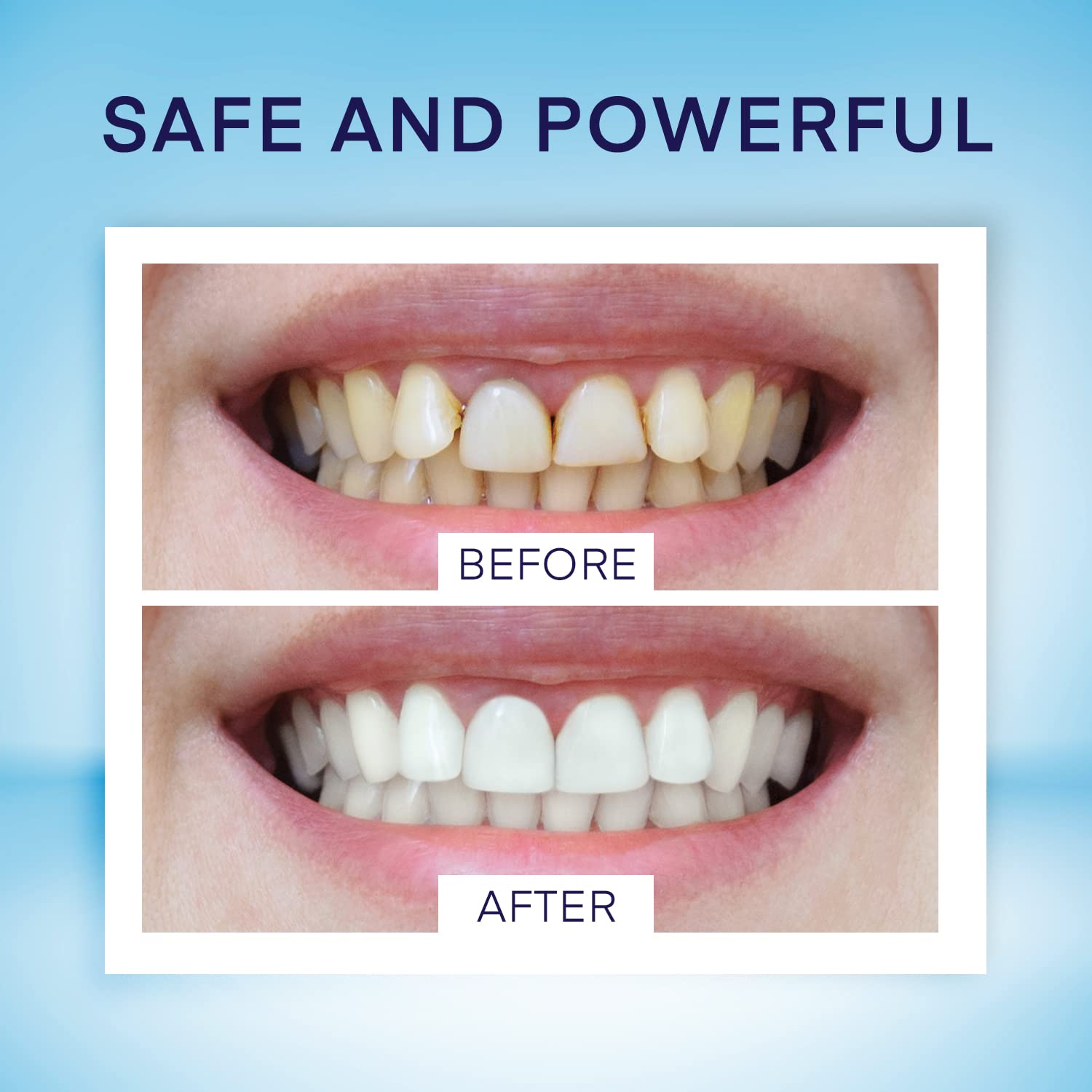 Whitening pen with twist mechanism and clear tube