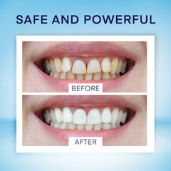 Whitening pen with twist mechanism and clear tube