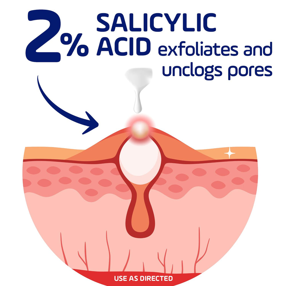 Asepxia fast results gentle on skin with daily use potential.