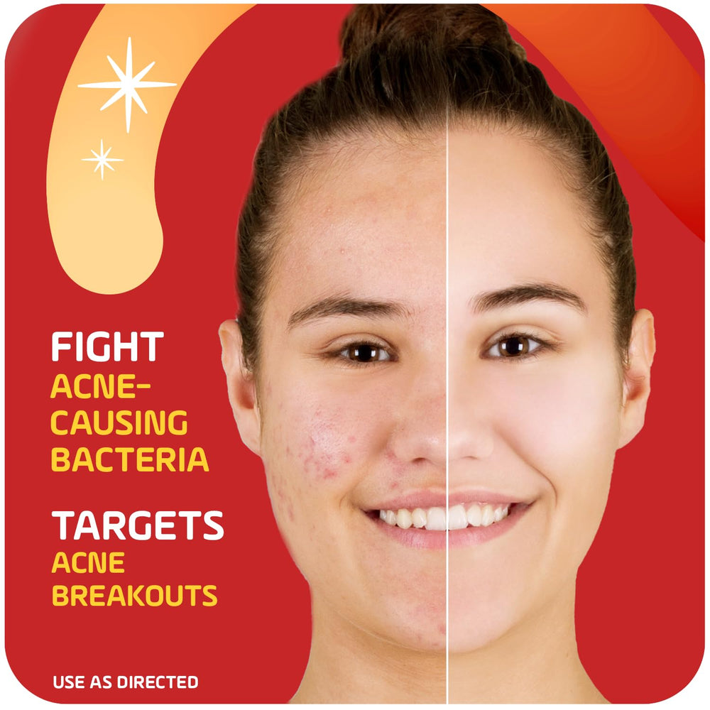 Asepxia penetrates pores to help prevent new pimples while treating existing blemishes.