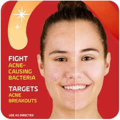 Asepxia penetrates pores to help prevent new pimples while treating existing blemishes.