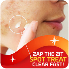 Close-up of Asepxia spot treatment cream tube showing quick-drying formula for on-the-go use.