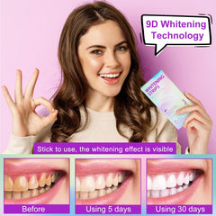 Use at home – convenient whitening strips