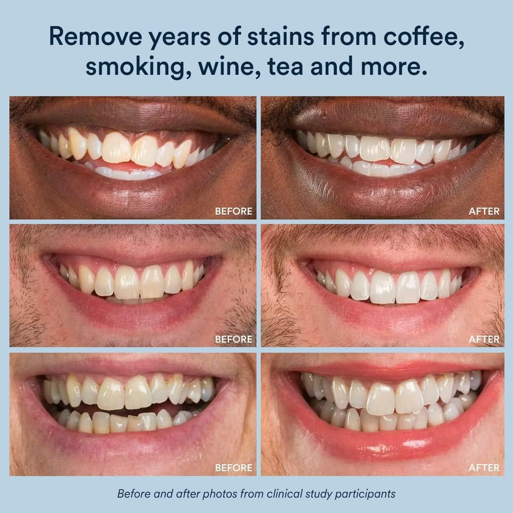 Illustration showing 40+ whitening treatments in the Auraglow pen