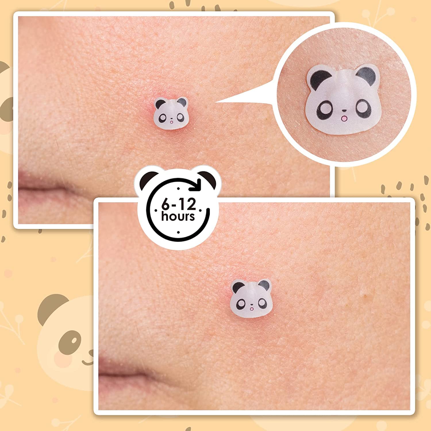AUSLKA Panda Patches thicker dots provide longer protection while staying lightweight