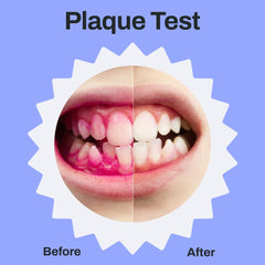 Illustration of 360-degree full-mouth coverage