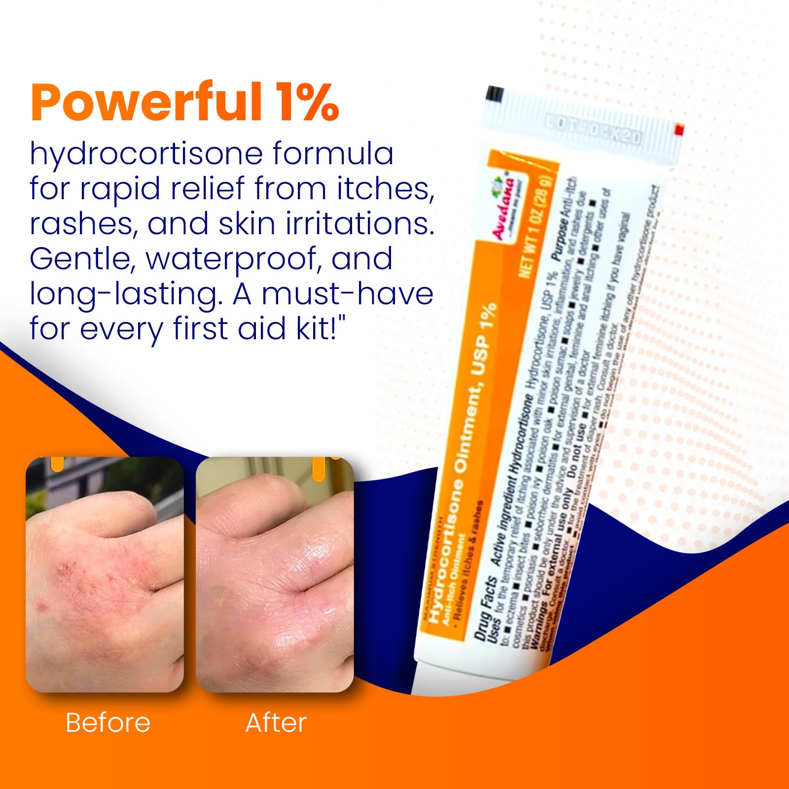 Close-up of AVEDANA label showing 1% hydrocortisone strength.