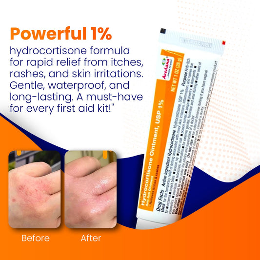 Close-up of AVEDANA label showing 1% hydrocortisone strength.