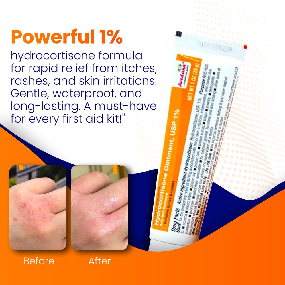 Close-up of AVEDANA label showing 1% hydrocortisone strength.