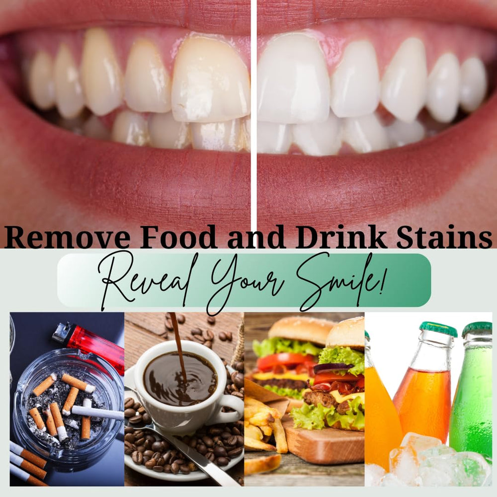 Advice to avoid staining foods and drinks between treatments