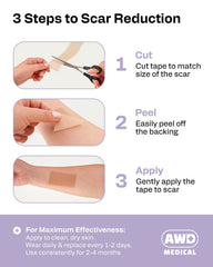 AWD Medical silicone scar tape close-up highlights soft, non-irritating material.