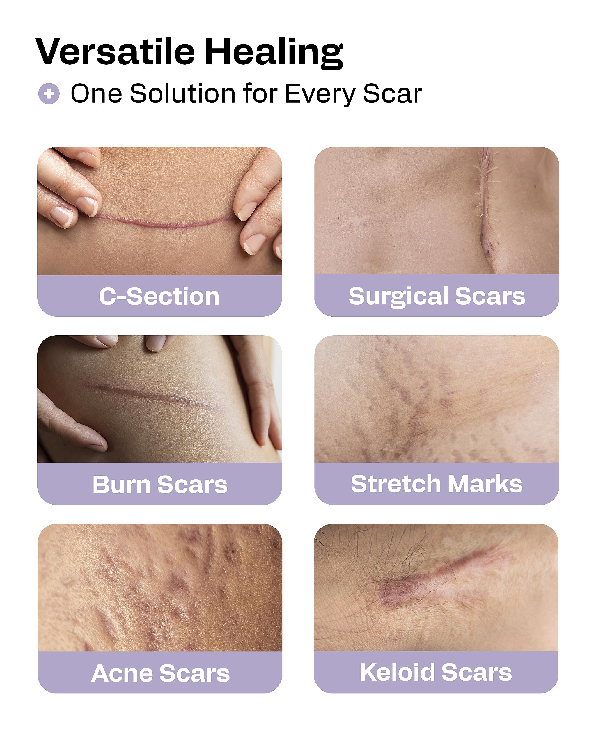 AWD silicone scar sheet shown as reusable and washable for long-term use.