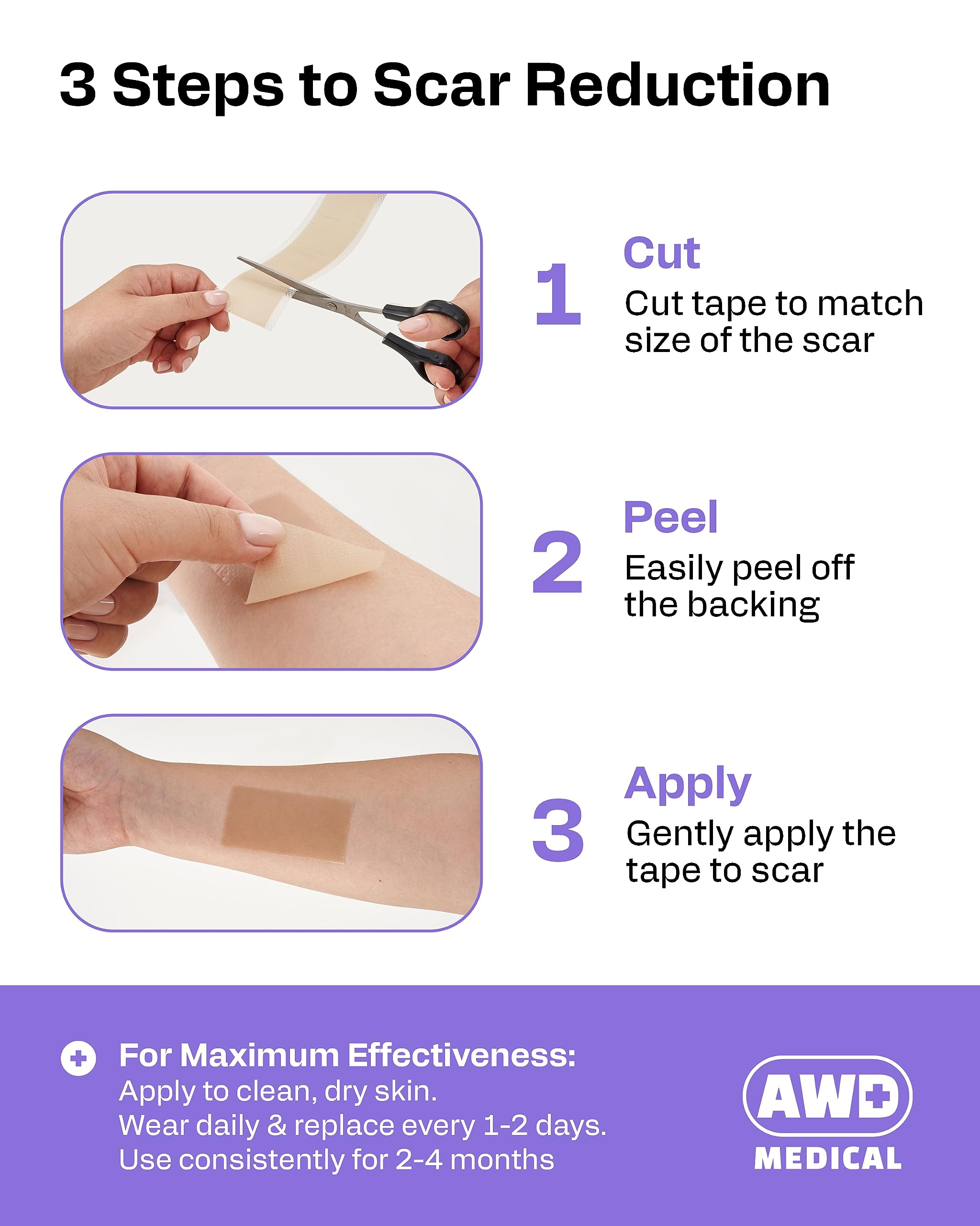 AWD Medical silicone scar tape over a surgical scar provides hydration and comfort