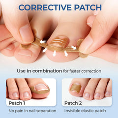 awrose 16 correction strips flexible and trim-to-fit