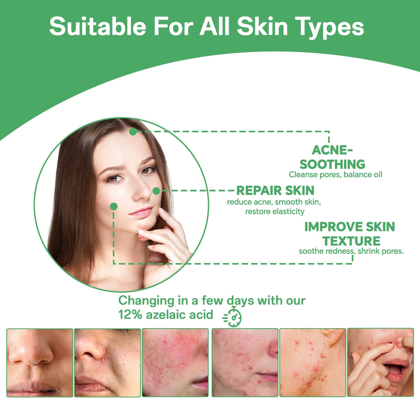 Azelaic acid 14% serum daily routine shot suitable for morning use.