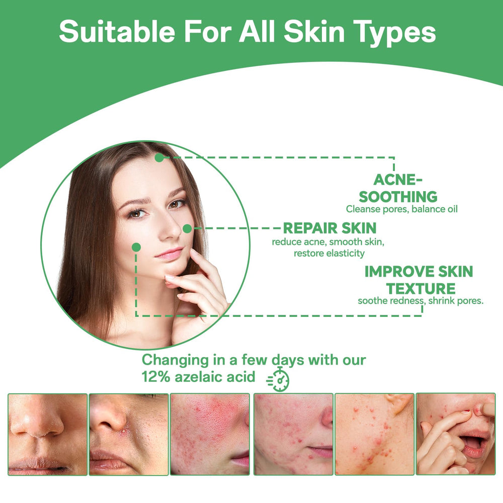 Azelaic acid 14% serum daily routine shot suitable for morning use.