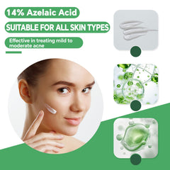 Azelaic acid 14% serum pore smoothing depiction on clean skin.