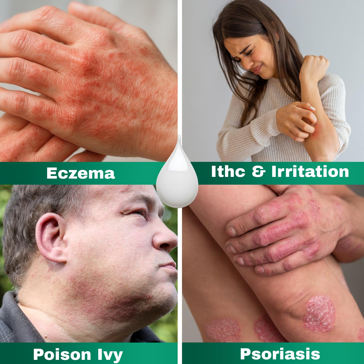 Barmicil Plus Cream with aloe vera signals soothing hydration