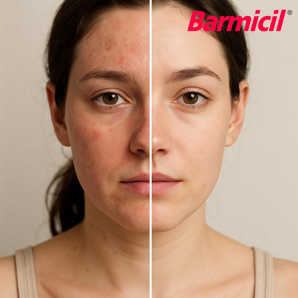 Barmicil Plus Cream packaging front indicates travel-friendly compact size