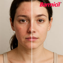 Barmicil Plus Cream packaging front indicates travel-friendly compact size