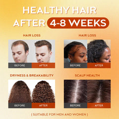 Applying Batana oil to hair scalp