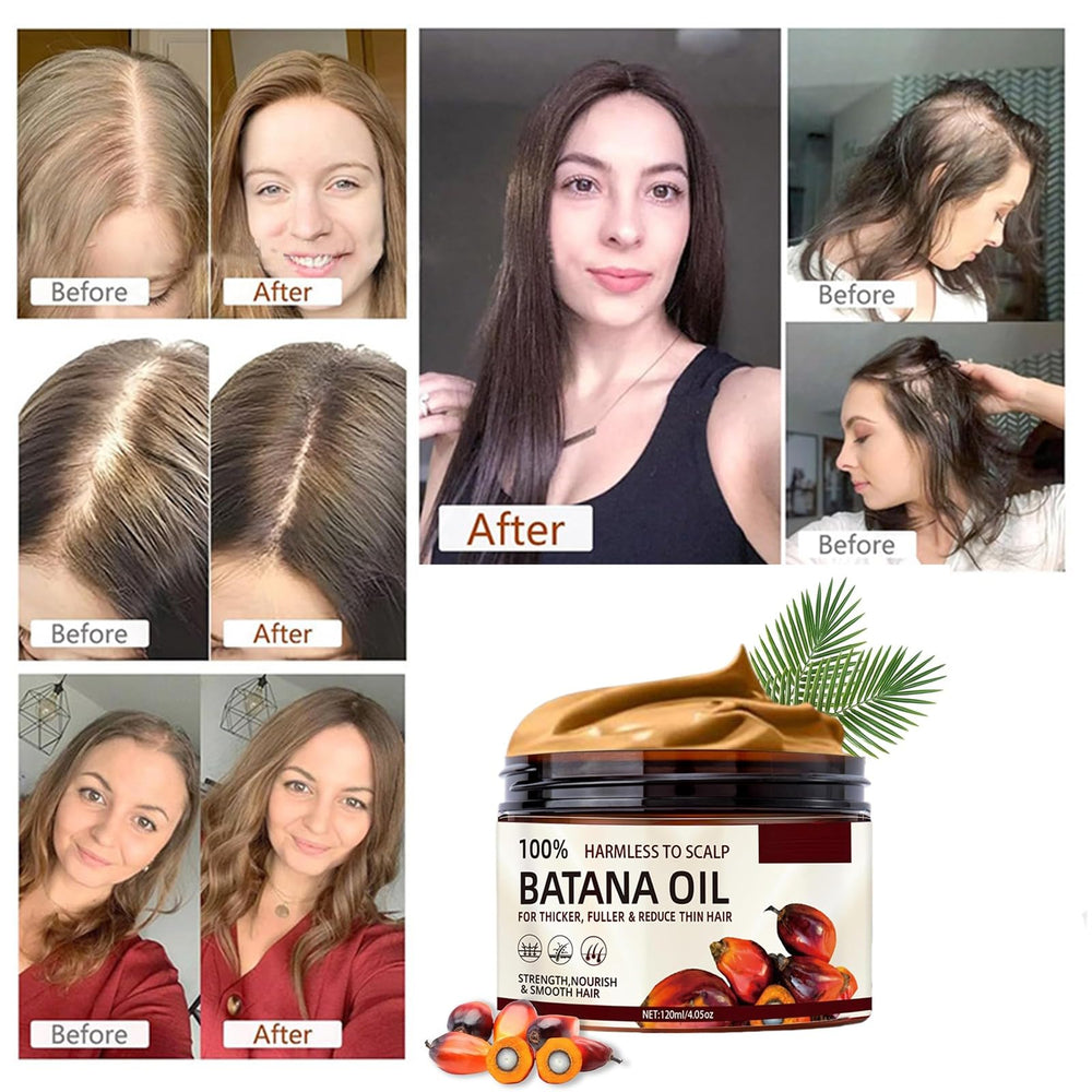 Batana Oil moisturizes the scalp for dry scalp relief.