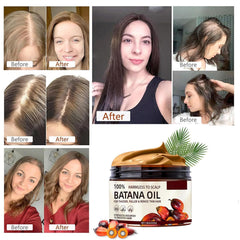 Batana Oil moisturizes the scalp for dry scalp relief.