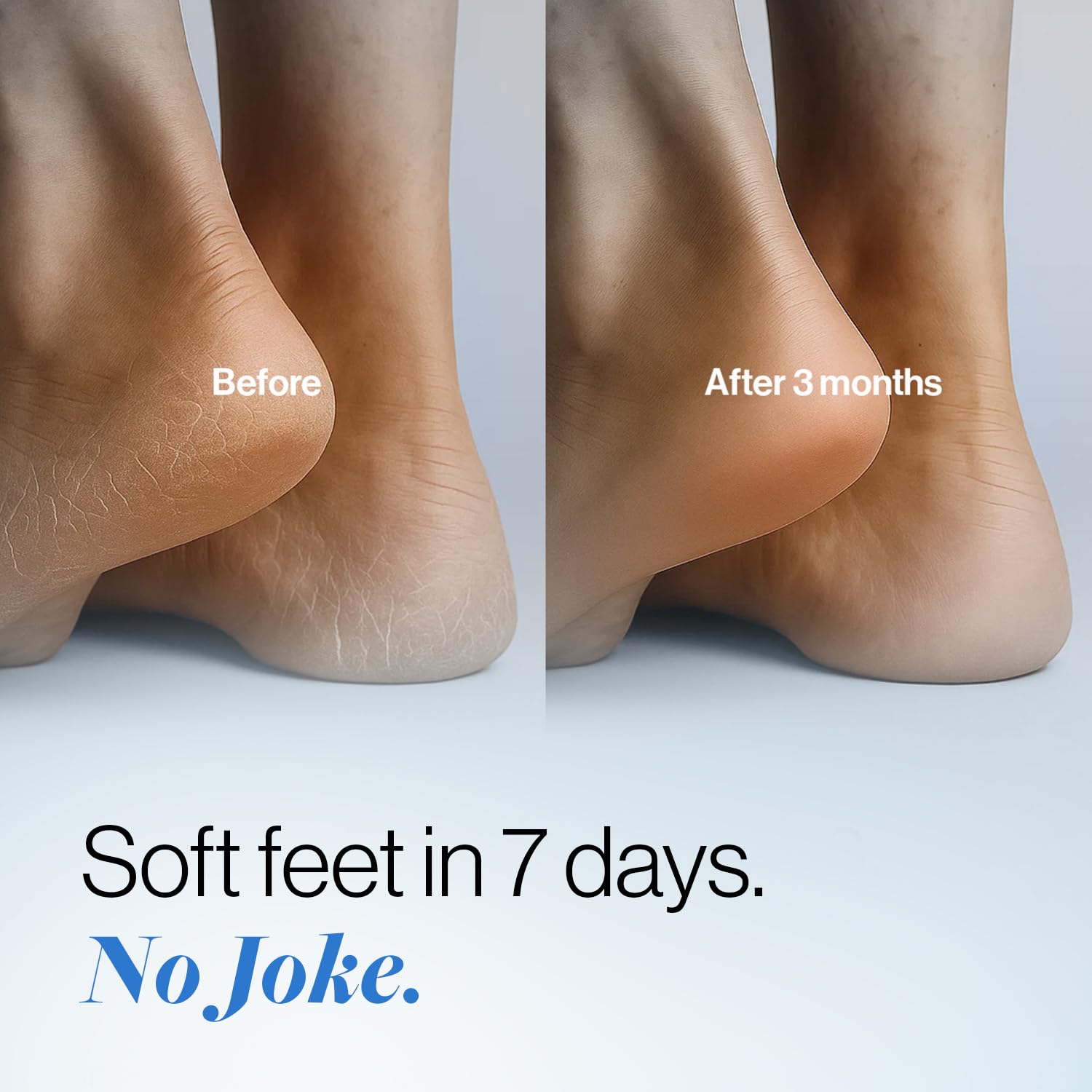 Be Bodywise dry heel before-use closeup highlighting rough skin area.