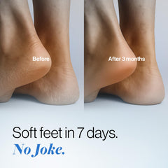 Be Bodywise dry heel before-use closeup highlighting rough skin area.