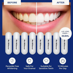 Before and after teeth whitening results showing stain removal