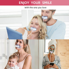 Before and after teeth whitening results