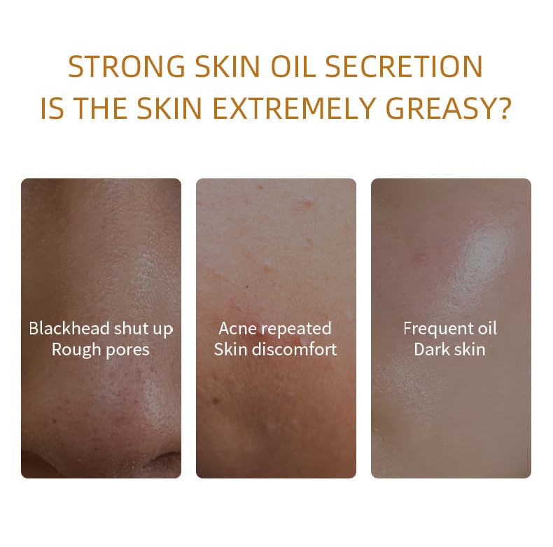 BERVEAL clay mask green tea focus suggests soothing, refreshing care