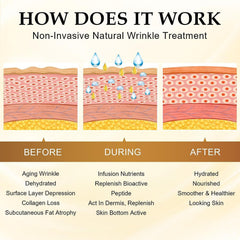 BERVEAL Thin clear patches stay discreet during night use