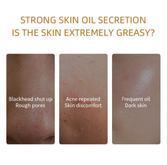 BERVEAL Organic Clay Mask Kit jar texture closeup shows creamy mud for deep cleansing.