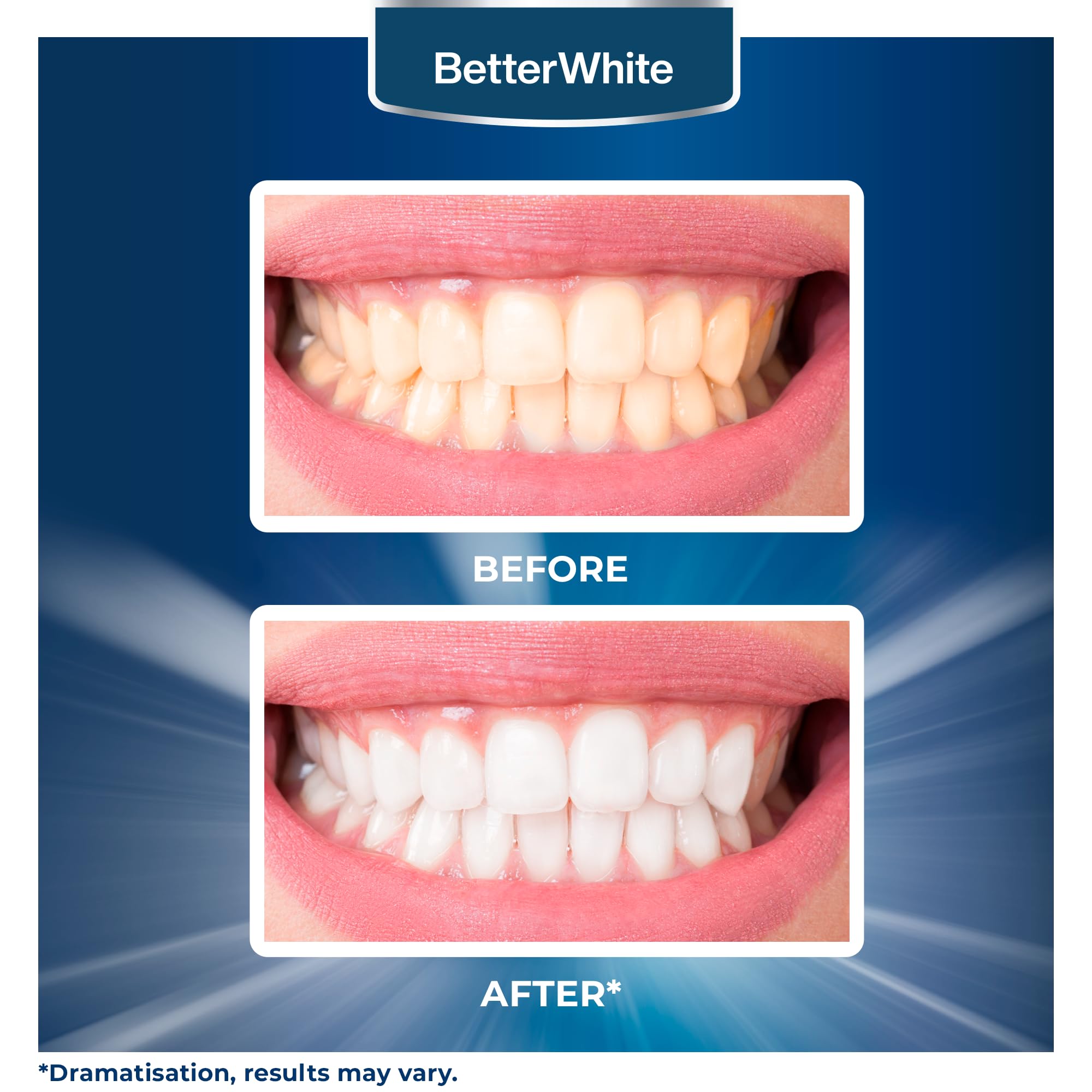 Before and after whitening results with BetterWhite