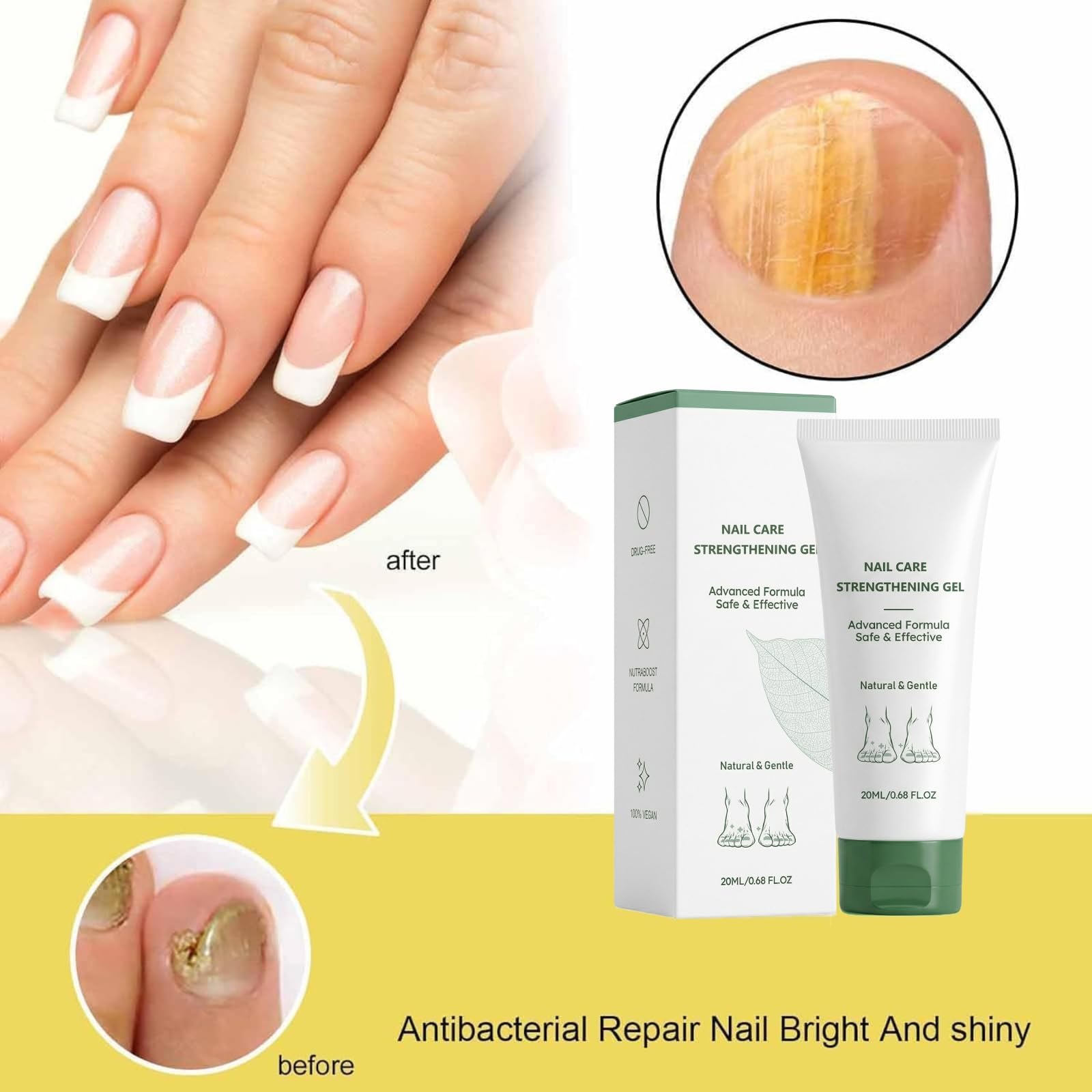 Beuifvo Nail Fungus Treatment Gel packaging box with compact design.