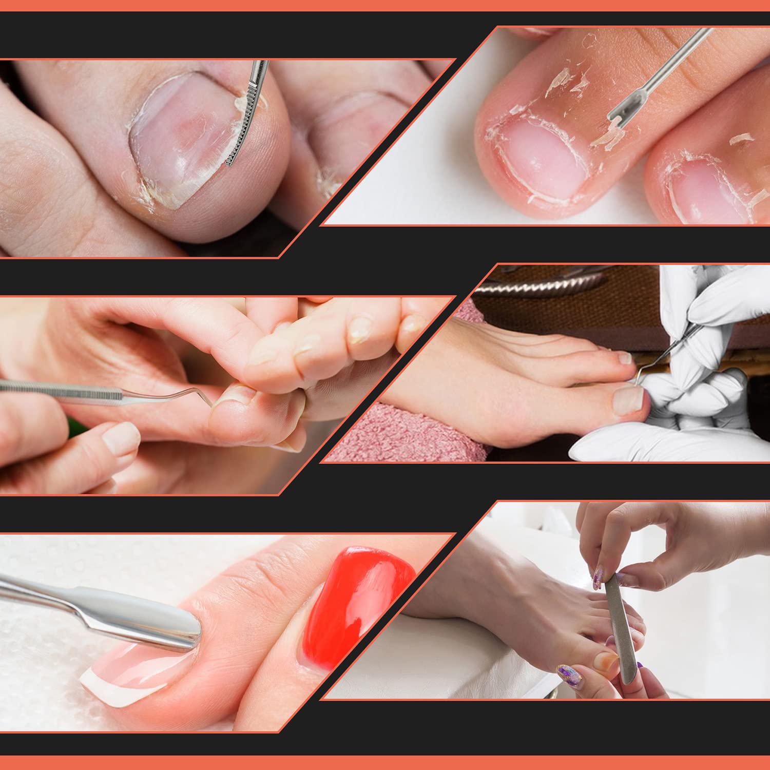 BEZOX nail pushers and lifters essential for pedicure.