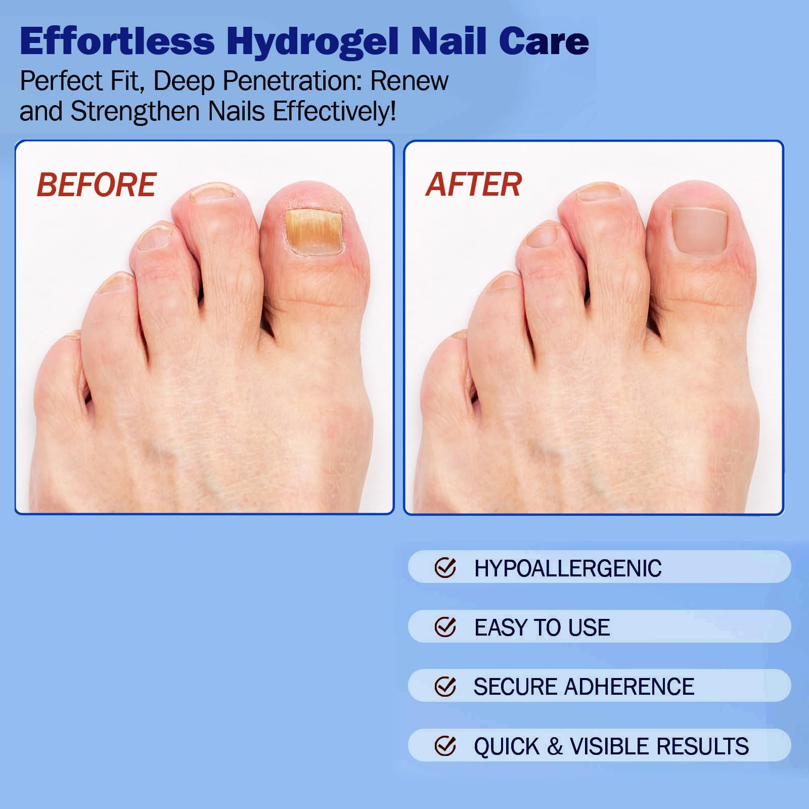 BFGCKJ deep-nail support helps maintain moisture balance in the nail bed