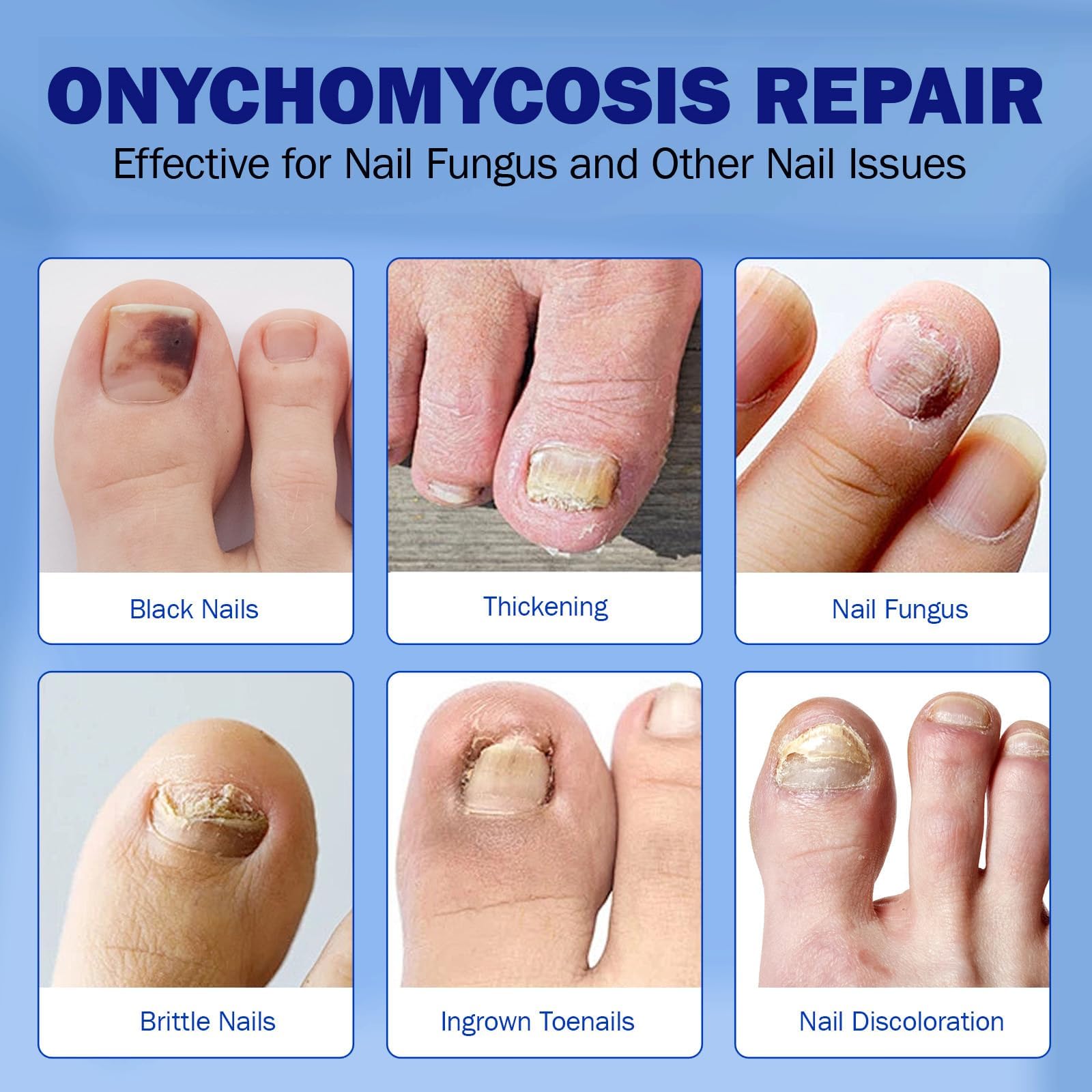 BFGCKJ nightly-care routine supports consistent use for healthier-looking nails