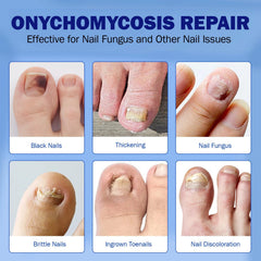 BFGCKJ nightly-care routine supports consistent use for healthier-looking nails