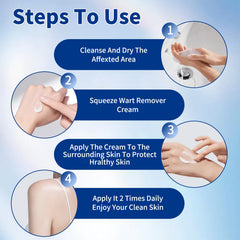 Bighero common wart removal focuses on safe self-treatment at home