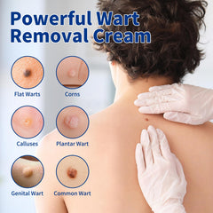Bighero wart gel application demonstrates easy, mess-free topical application
