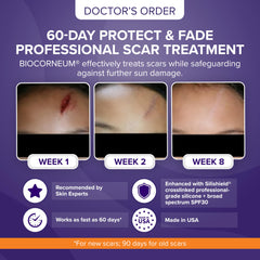 BIOCORNEUM advanced-scar-treatment-application demonstrates easy gel application for new and old scars.